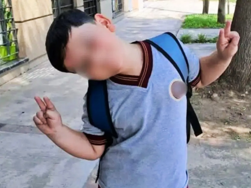 Trasladaron al nene que se accidentó en Pinamar a Mar del Plata para una nueva cirugía